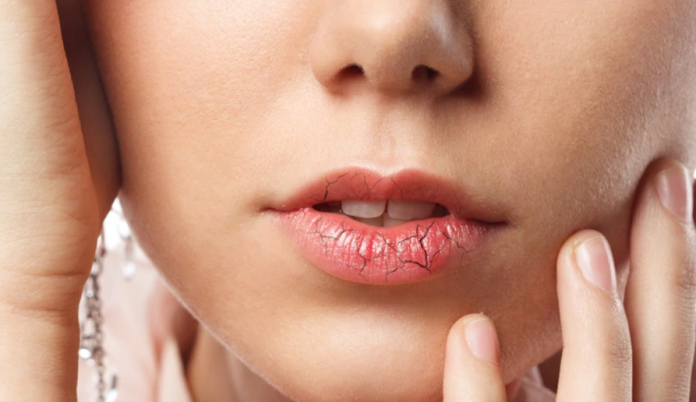 Remedios caseros para que acabes con la resequedad de tus labios