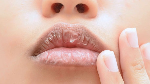 4 remedios caseros para que elimines la resequedad y las grietas de tus labios